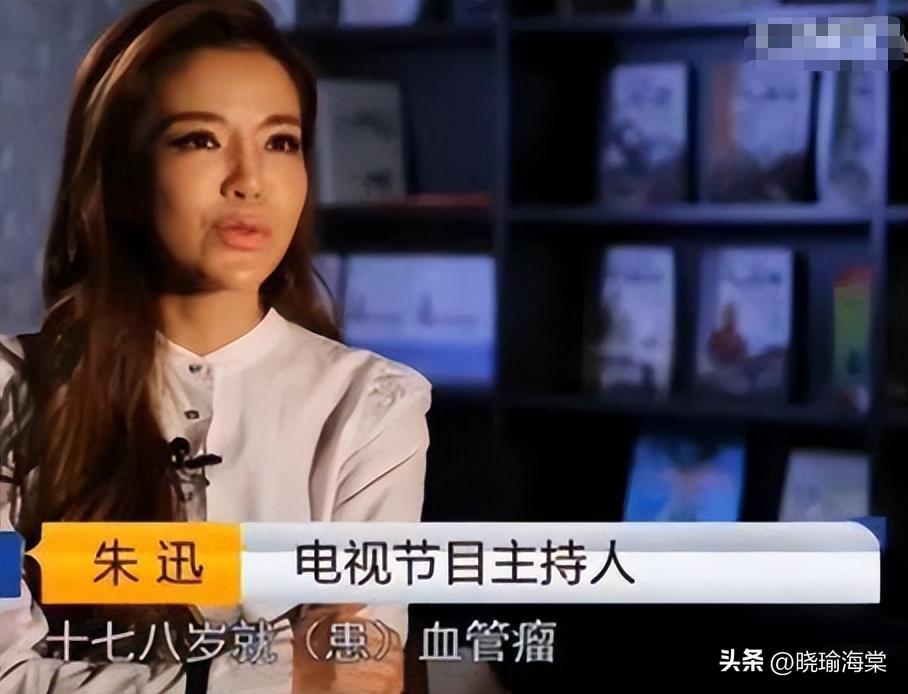 央视主持人朱迅：生命终将结束，为何不勇敢面对人生的终点呢